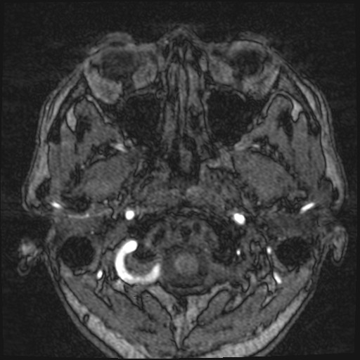 Click on the Serie image to view the images of VILLANUEVA, WILLIAM A.